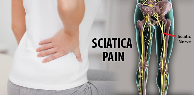 symptoms-of-sciatica