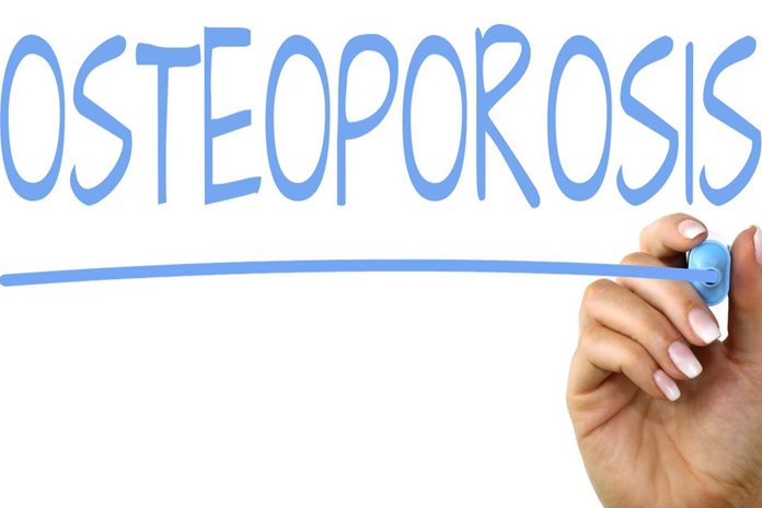 Osteoporosis