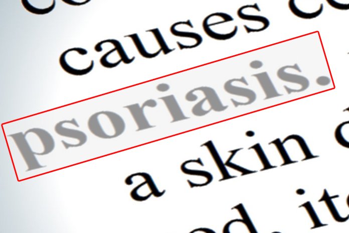 Psoriasis