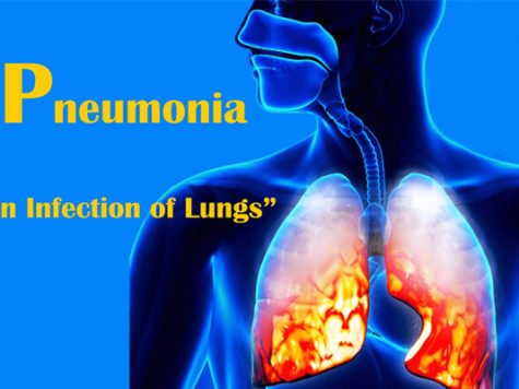 Pneumonia